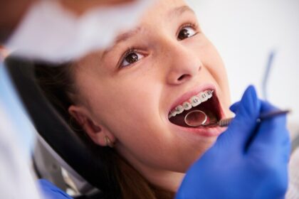 What to Expect During Your First Week with Braces