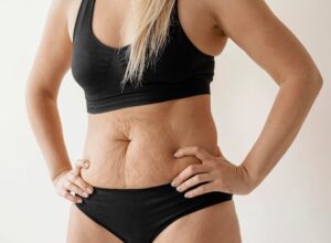 How Much Does Lipo Abdominoplasty Cost?