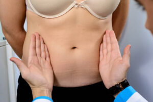 Quick Tips for Tummy Tuck Cost: A Beginner's Guide