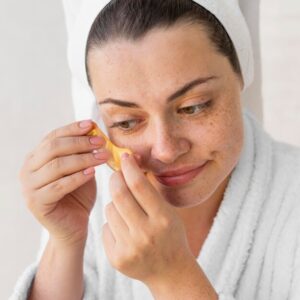 The Journey to Clear Skin: Melasma Treatment