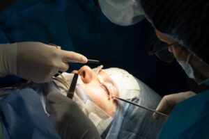 What Are the Risks of Eyelid Surgery?