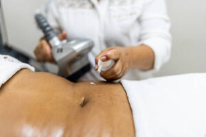 Why You Should Worry About Laser Liposuction