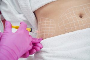 Everything You Need to Know About Fat Melting Injections